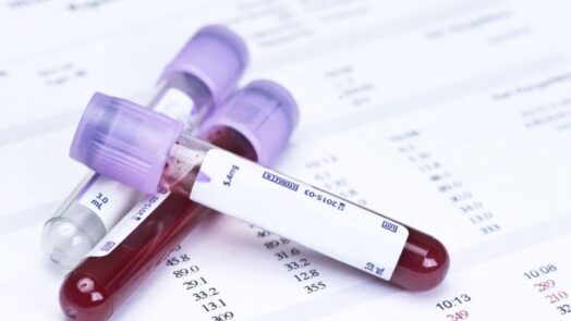https://www.eurosalus.com/wp-content/uploads/2023/10/Dal-prediabete-al-diabete-perche-l-emoglobina-glicata-non-aiuta-a-capire-l-evoluzione-della-malattia_articleimage-4-524x295.jpg
