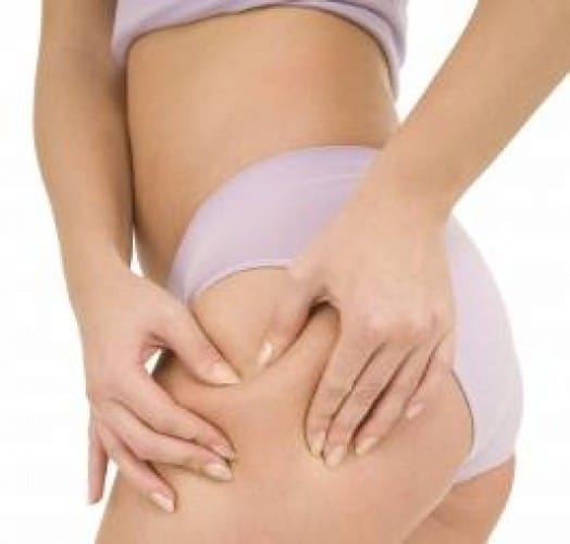 Oggi parliamo di: cellulite