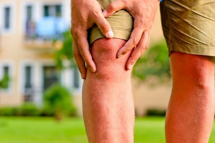 Omega 3: ne bastano meno del previsto per trattare l'artrite del ginocchio