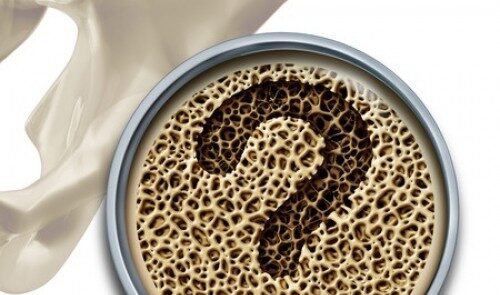 https://www.eurosalus.com/wp-content/uploads/2023/10/Osteoporosi-e-se-fossero-alterati-i-parametri-di-riferimento_articleimage-4-500x295.jpg