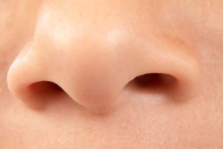 Poliposi nasale: ecco cosa fare