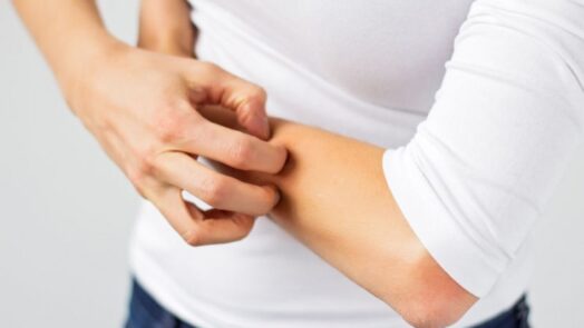 https://www.eurosalus.com/wp-content/uploads/2023/10/SNAS-e-sindrome-da-allergia-sistemica-al-Nichel_articleimage-4-524x295.jpg